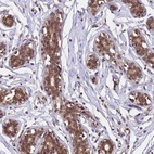 Anti-C1orf35 Antibody
