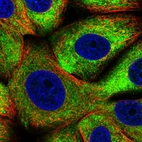 Immunofluorescent staining of human cell line MCF7 shows localization to cytosol.