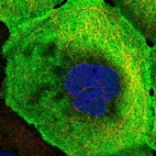 Immunofluorescent staining of human cell line A-431 shows localization to plasma membrane & cytosol.