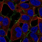 Immunofluorescent staining of human cell line SH-SY5Y shows localization to plasma membrane.