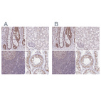 Anti-PTPN2 Antibody