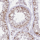 Anti-PTPN2 Antibody