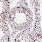 Immunohistochemical staining of human Testis shows moderate nuclear positivity in cells in seminiferous ducts and Leydig cells.