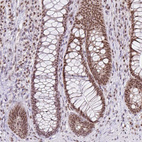 Immunohistochemical staining of human Rectum shows moderate nuclear positivity in glandular cells.