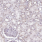 Anti-PTPN2 Antibody