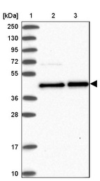 Anti-PTPN2 Antibody