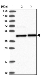 Lane 1: Marker [kDa] 250, 130, 95, 72, 55, 36, 28, 17, 10_br/_Lane 2: Human cell line RT-4_br/_Lane 3: Human cell line U-251MG sp