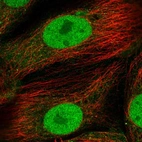 Immunofluorescent staining of human cell line CACO-2 shows localization to nucleoplasm & cytosol.