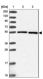 Lane 1: Marker [kDa] 250, 130, 95, 72, 55, 36, 28, 17, 10_br/_Lane 2: Human cell line RT-4_br/_Lane 3: Human cell line U-251MG sp