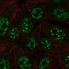 Anti-C12orf57 Antibody