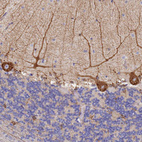 Anti-GDAP2 Antibody