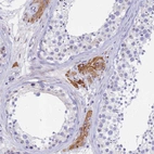 Immunohistochemical staining of human testis shows moderate granular cytoplasmic positivity in Leydig cells.