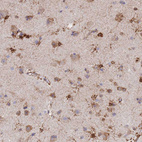 Anti-GDAP2 Antibody