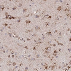 Immunohistochemical staining of human cerebral cortex shows strong granular cytoplasmic positivity in glial cells.