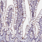 Immunohistochemical staining of human gastrointestinal shows strong cytoplasmic positivity in a subset of glandular cells.