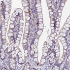 Immunohistochemical staining of human gastrointestinal shows strong cytoplasmic positivity in a subset of glandular cells.