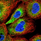 Immunofluorescent staining of human cell line A-431 shows localization to endoplasmic reticulum.