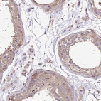 Anti-WDR64 Antibody