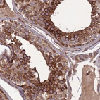 Anti-MAB21L3 Antibody