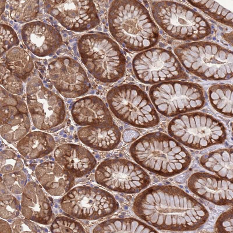 Anti-FOXRED1 Antibody