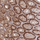 Anti-FOXRED1 Antibody