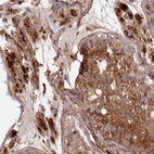 Anti-C2CD5 Antibody