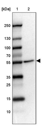 Lane 1: Marker [kDa] 250, 130, 100, 70, 55, 35, 25, 15, 10_br/_Lane 2: Human cell line HEL