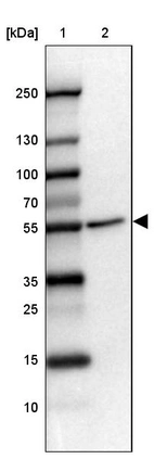 Lane 1: Marker [kDa] 250, 130, 100, 70, 55, 35, 25, 15, 10_br/_Lane 2: Human cell line HEL
