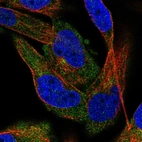 Immunofluorescent staining of human cell line RH-30 shows localization to cytosol & microtubule organizing center.