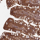 Anti-GRTP1 Antibody