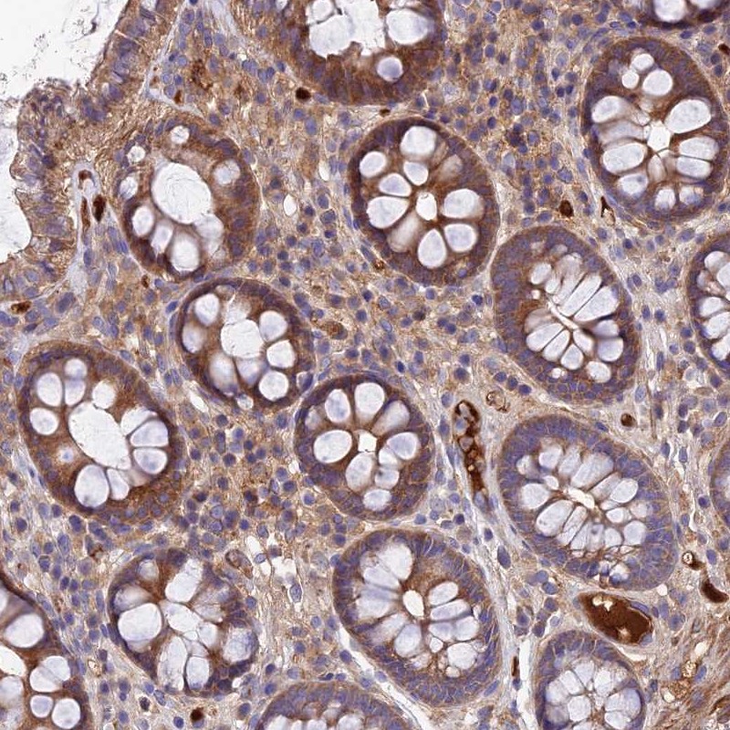 Anti-PYM1 Antibody