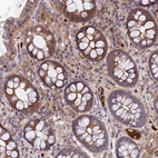 Anti-PYM1 Antibody