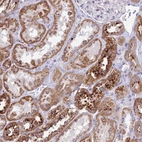 Anti-PNLIPRP3 Antibody