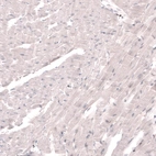 Immunohistochemical staining of mouse heart shows no positivity in cardiomyocytes as expected.