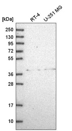 Anti-ADAL Antibody