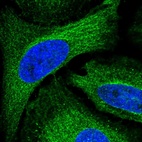 Immunofluorescent staining of human cell line HeLa shows localization to microtubules.