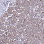 Anti-CRACR2B Antibody