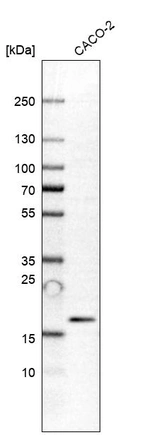 Western blot analysis in human cell line CACO-2.