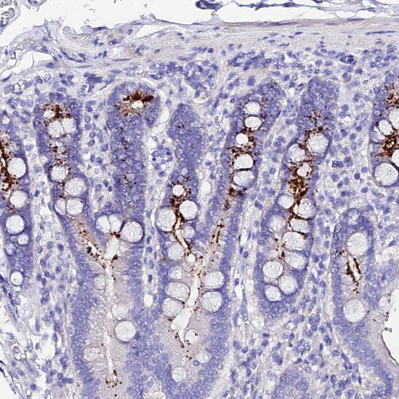 Anti-TMEM117 Antibody