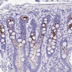 Anti-TMEM117 Antibody