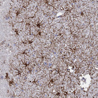 Anti-SYT13 Antibody