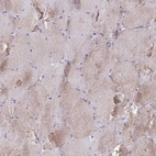 Immunohistochemical staining of human skeletal muscle shows moderate cytoplasmic positivity in myocytes.