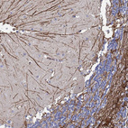 Anti-SYT13 Antibody