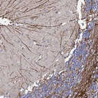 Immunohistochemical staining of human Cerebellum shows strong positivity in neuronal processes in cells in molecular layer.