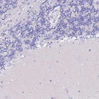 Immunohistochemical staining of human cerebellum shows no positivity in Purkinje cells as expected.