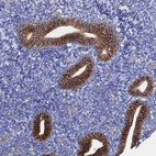 Immunohistochemical staining of human Endometrium shows moderate membranous positivity in glandular cells.