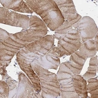 Immunohistochemical staining of human Skeletal muscle shows moderate cytoplasmic positivity in myocytes.