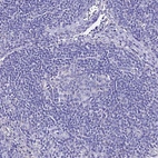 Immunohistochemical staining of human lymph node shows no positivity in non-germinal center cells as expected.