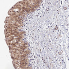 Anti-MTCL1 Antibody