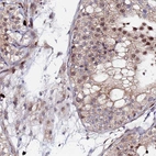 Immunohistochemical staining of human testis shows moderate nuclear/cytoplasmic positivity in cells in seminiferous ducts and Leydig cells.